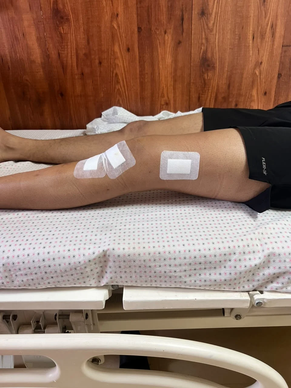 ACL Ligament Rehabilitation